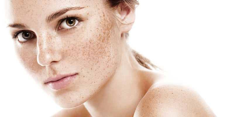 Стрес та шкіра: що потрібно знати про гіперчутливість